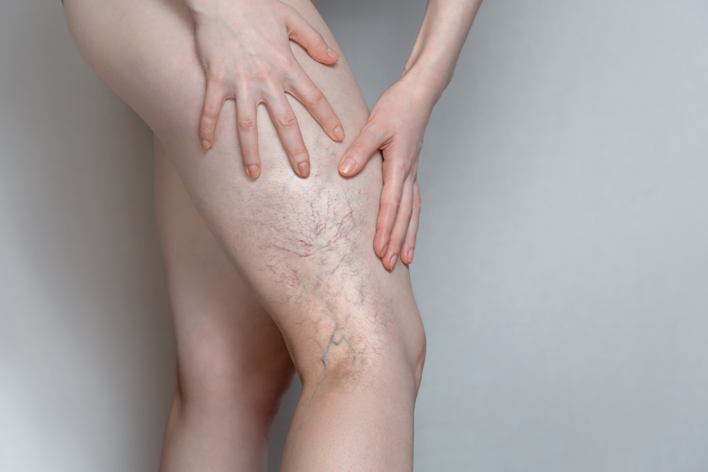 Ночные спазмы в мышцах ног: лечение, профилактика