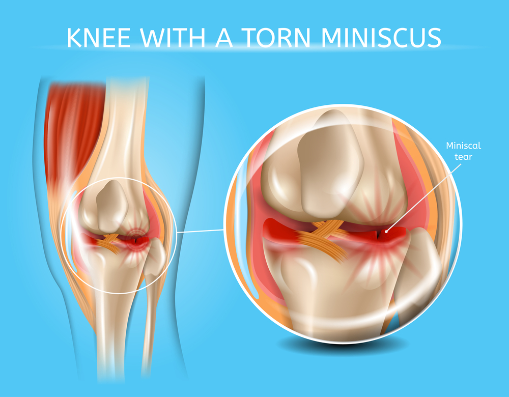 Почему болят колени: причины и необходимая диагностика